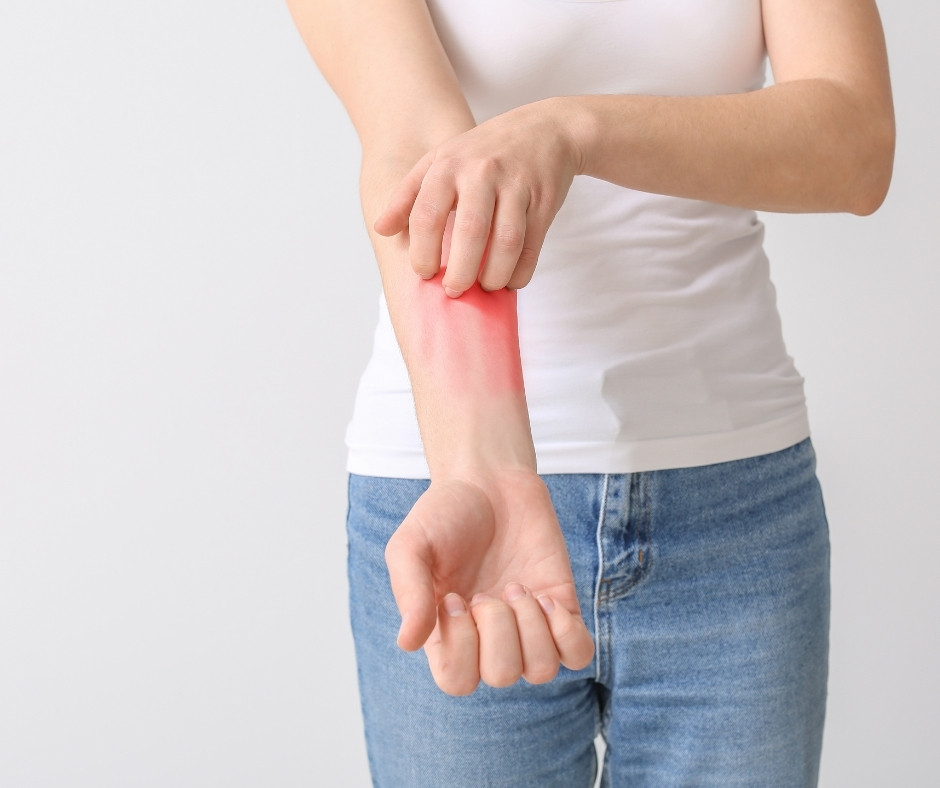 Alergia de Pele Fotos